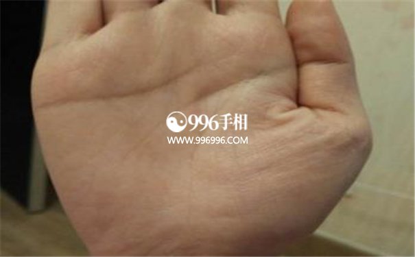 手掌与疾病对照表